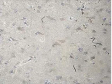 Immunohistochemistry (Formalin/PFA-fixed paraffin-embedded sections) - Anti-CHRNA9 antibody (AB177119)