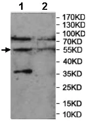 Western blot - Anti-CHRNA9 antibody (AB177119)