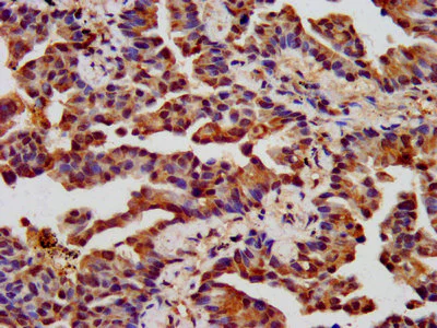Immunohistochemistry (Formalin/PFA-fixed paraffin-embedded sections) - Anti-CHRNB3 antibody (AB236745)