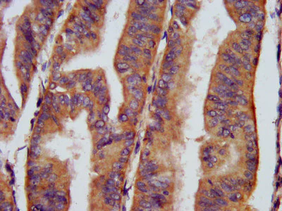 Immunohistochemistry (Formalin/PFA-fixed paraffin-embedded sections) - Anti-CHRNB3 antibody (AB236745)