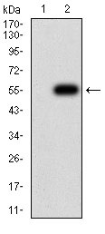 Western blot - Anti-CHRNB4 antibody [7F5B2] (AB233735)