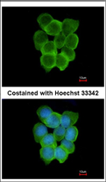 Immunocytochemistry/ Immunofluorescence - Anti-CHRND antibody - C-terminal (AB137536), expandable thumbnail