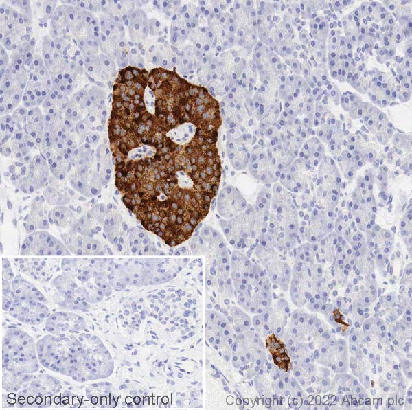 Immunohistochemistry (Formalin/PFA-fixed paraffin-embedded sections) - Anti-Chromogranin A antibody (AB15160), expandable thumbnail