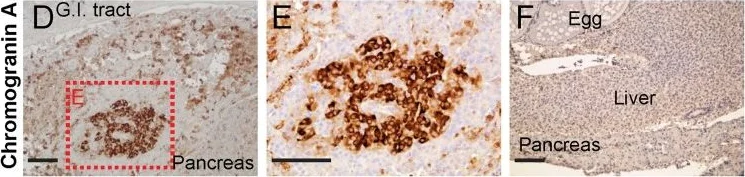Immunohistochemistry (Formalin/PFA-fixed paraffin-embedded sections) - Anti-Chromogranin A antibody (AB15160)