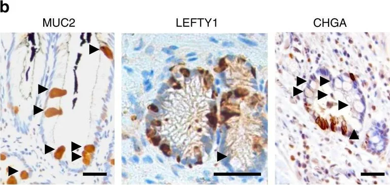 Immunohistochemistry - Anti-Chromogranin A antibody (AB15160)
