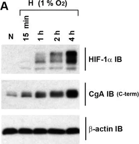 Western blot - Anti-Chromogranin A antibody (AB15160)
