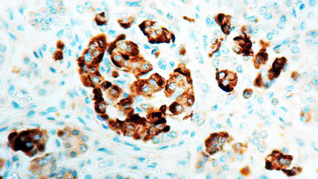 Immunohistochemistry (Formalin/PFA-fixed paraffin-embedded sections) - Anti-Chromogranin A antibody (AB17064)