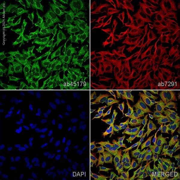 Immunocytochemistry/ Immunofluorescence - Anti-Chromogranin A antibody (AB45179)