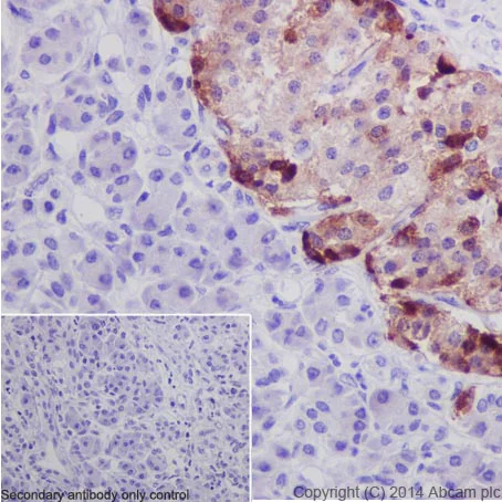 Immunohistochemistry (Formalin/PFA-fixed paraffin-embedded sections) - Anti-Chromogranin A antibody (AB45179)