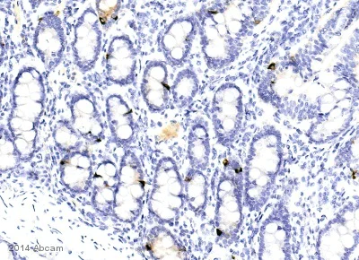 Immunohistochemistry (Formalin/PFA-fixed paraffin-embedded sections) - Anti-Chromogranin A antibody (AB45179)