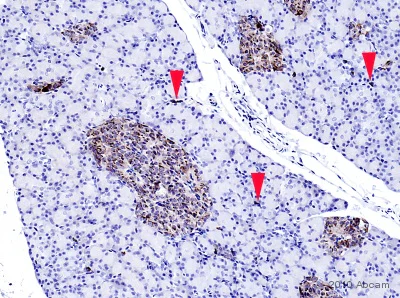 Immunohistochemistry (Formalin/PFA-fixed paraffin-embedded sections) - Anti-Chromogranin A antibody (AB45179)