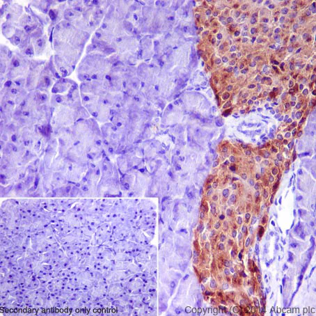 Immunohistochemistry (Formalin/PFA-fixed paraffin-embedded sections) - Anti-Chromogranin A antibody (AB45179)
