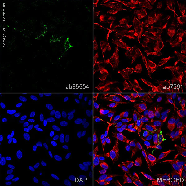 Immunocytochemistry/ Immunofluorescence - Anti-Chromogranin A antibody (AB85554)
