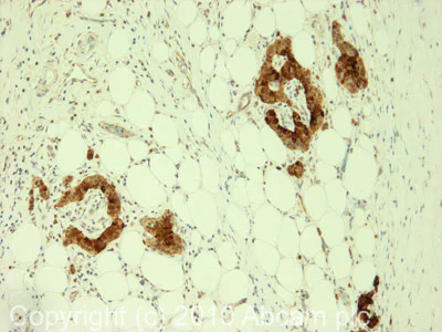 Immunohistochemistry (Formalin/PFA-fixed paraffin-embedded sections) - Anti-Chromogranin A antibody (AB85554)