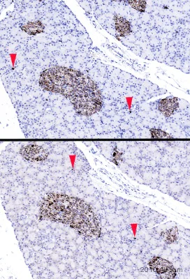Immunohistochemistry (Formalin/PFA-fixed paraffin-embedded sections) - Anti-Chromogranin A antibody (AB85554)