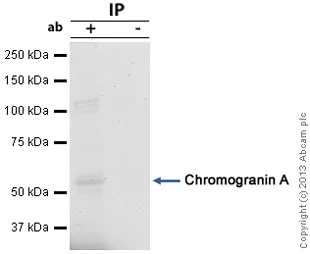 Immunoprecipitation - Anti-Chromogranin A antibody (AB85554)