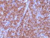 Immunohistochemistry (Formalin/PFA-fixed paraffin-embedded sections) - Anti-Chromogranin A antibody [CGA/413] (AB220189), expandable thumbnail