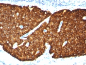 Immunohistochemistry (Formalin/PFA-fixed paraffin-embedded sections) - Anti-Chromogranin A antibody [CGA/413] (AB220189), expandable thumbnail