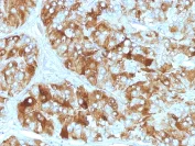 Immunohistochemistry (Formalin/PFA-fixed paraffin-embedded sections) - Anti-Chromogranin A antibody [CGA/413] - BSA and Azide free (AB269806)