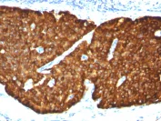 Immunohistochemistry (Formalin/PFA-fixed paraffin-embedded sections) - Anti-Chromogranin A antibody [CGA/413] - BSA and Azide free (AB269806)