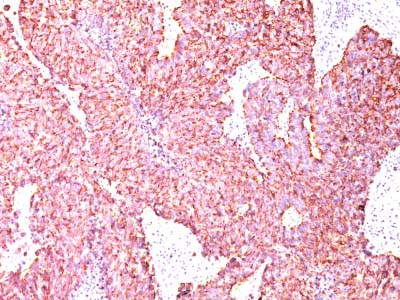 Immunohistochemistry (Formalin/PFA-fixed paraffin-embedded sections) - Anti-Chromogranin A antibody [CGA/414] - BSA and Azide free (AB212287), expandable thumbnail