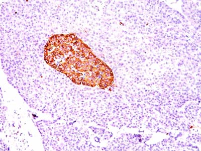 Immunohistochemistry (Formalin/PFA-fixed paraffin-embedded sections) - Anti-Chromogranin A antibody [CGA/414] - BSA and Azide free (AB212287), expandable thumbnail
