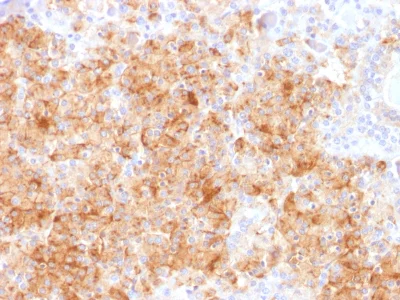 Immunohistochemistry (Formalin/PFA-fixed paraffin-embedded sections) - Anti-Chromogranin A antibody [CHGA/1731R] - BSA and Azide free (AB237820)