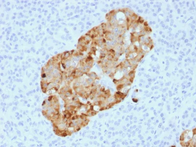 Immunohistochemistry (Formalin/PFA-fixed paraffin-embedded sections) - Anti-Chromogranin A antibody [CHGA/1731R] - BSA and Azide free (AB237820)