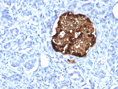 Immunohistochemistry (Formalin/PFA-fixed paraffin-embedded sections) - Anti-Chromogranin A antibody [CHGA/1815R] - BSA and Azide free (AB237821), expandable thumbnail