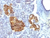 Immunohistochemistry (Formalin/PFA-fixed paraffin-embedded sections) - Anti-Chromogranin A antibody [CHGA/777] (AB220190)