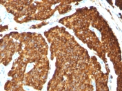 Immunohistochemistry (Formalin/PFA-fixed paraffin-embedded sections) - Anti-Chromogranin A antibody [CHGA/777] (AB220190), expandable thumbnail