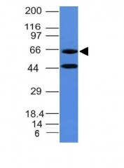 Western blot - Anti-Chromogranin A antibody [CHGA/777] (AB220190), expandable thumbnail