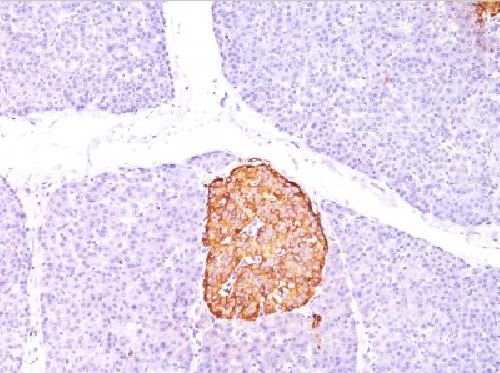 Immunohistochemistry (Formalin/PFA-fixed paraffin-embedded sections) - Anti-Chromogranin A antibody [CHGA/798] (AB220191)