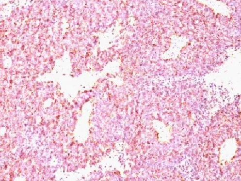 Immunohistochemistry (Formalin/PFA-fixed paraffin-embedded sections) - Anti-Chromogranin A antibody [CHGA/798] (AB220191)