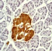 Immunohistochemistry (Formalin/PFA-fixed paraffin-embedded sections) - Anti-Chromogranin A antibody [EP1030Y] (AB68271)