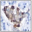 Immunohistochemistry (Formalin/PFA-fixed paraffin-embedded sections) - Anti-Chromogranin A antibody [EP1031Y] - BSA and Azide free (AB247345)