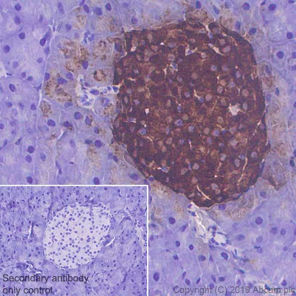 Immunohistochemistry (Formalin/PFA-fixed paraffin-embedded sections) - Anti-Chromogranin A antibody [EPR22537-248] (AB254322)