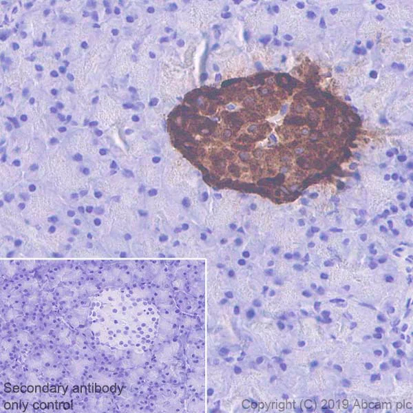Immunohistochemistry (Formalin/PFA-fixed paraffin-embedded sections) - Anti-Chromogranin A antibody [EPR22537-248] (AB254322)