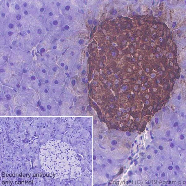 Immunohistochemistry (Formalin/PFA-fixed paraffin-embedded sections) - Anti-Chromogranin A antibody [EPR22537-249] - BSA and Azide free (AB256169)