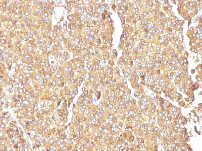 Immunohistochemistry (Formalin/PFA-fixed paraffin-embedded sections) - Anti-Chromogranin A antibody [LK2H10] - BSA and Azide free (AB212290)