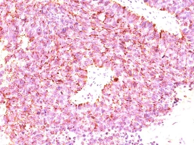 Immunohistochemistry (Formalin/PFA-fixed paraffin-embedded sections) - Anti-Chromogranin A antibody [LK2H10 + PHE5 + CGA/414] - BSA and Azide free (AB212295)