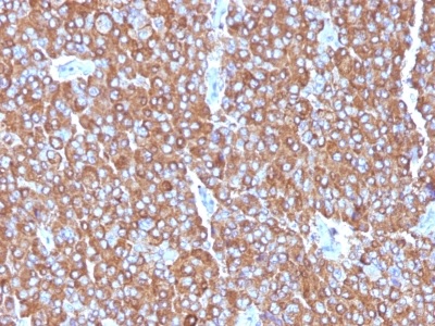 Immunohistochemistry (Formalin/PFA-fixed paraffin-embedded sections) - Anti-Chromogranin A antibody [LK2H10 + PHE5 + CGA/414] - BSA and Azide free (AB212295)