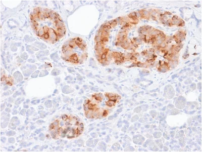 Immunohistochemistry (Formalin/PFA-fixed paraffin-embedded sections) - Anti-Chromogranin A antibody [rCHGA/413] (AB237978)