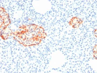 Immunohistochemistry (Formalin/PFA-fixed paraffin-embedded sections) - Anti-Chromogranin A antibody [rCHGA/798] - BSA and Azide free (AB237818), expandable thumbnail
