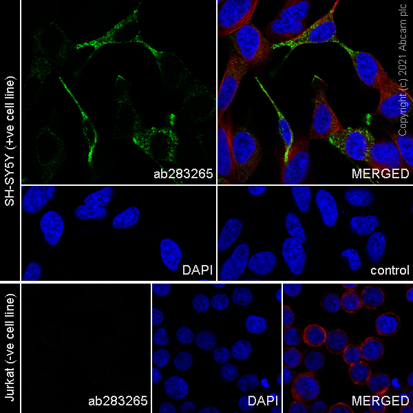 Immunocytochemistry/ Immunofluorescence - Anti-Chromogranin A antibody [RM1025] (ab283265), expandable thumbnail