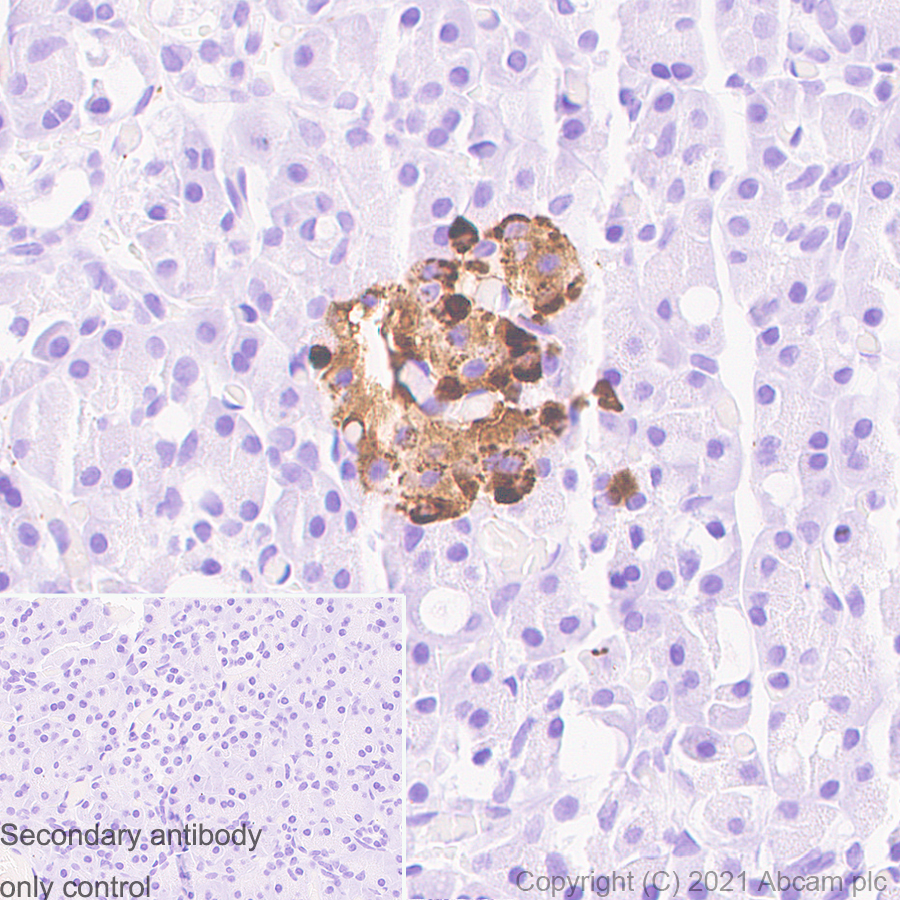 Immunohistochemistry (Formalin/PFA-fixed paraffin-embedded sections) - Anti-Chromogranin A antibody [RM1025] (AB283265), expandable thumbnail