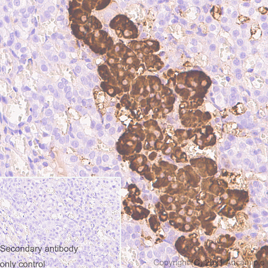 Immunohistochemistry (Formalin/PFA-fixed paraffin-embedded sections) - Anti-Chromogranin A antibody [RM1025] (ab283265), expandable thumbnail