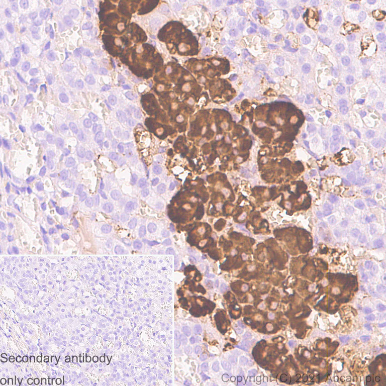Immunohistochemistry (Formalin/PFA-fixed paraffin-embedded sections) - Anti-Chromogranin A antibody [RM1025] (AB283265)