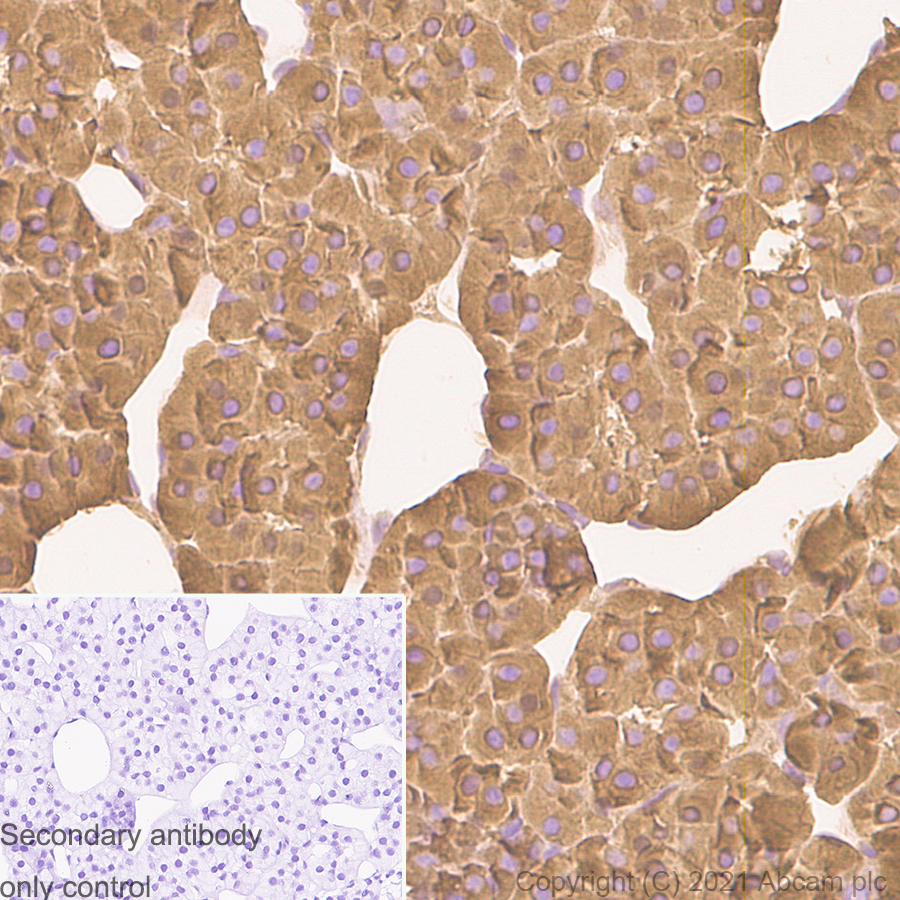 Immunohistochemistry (Formalin/PFA-fixed paraffin-embedded sections) - Anti-Chromogranin A antibody [RM1025] (ab283265), expandable thumbnail
