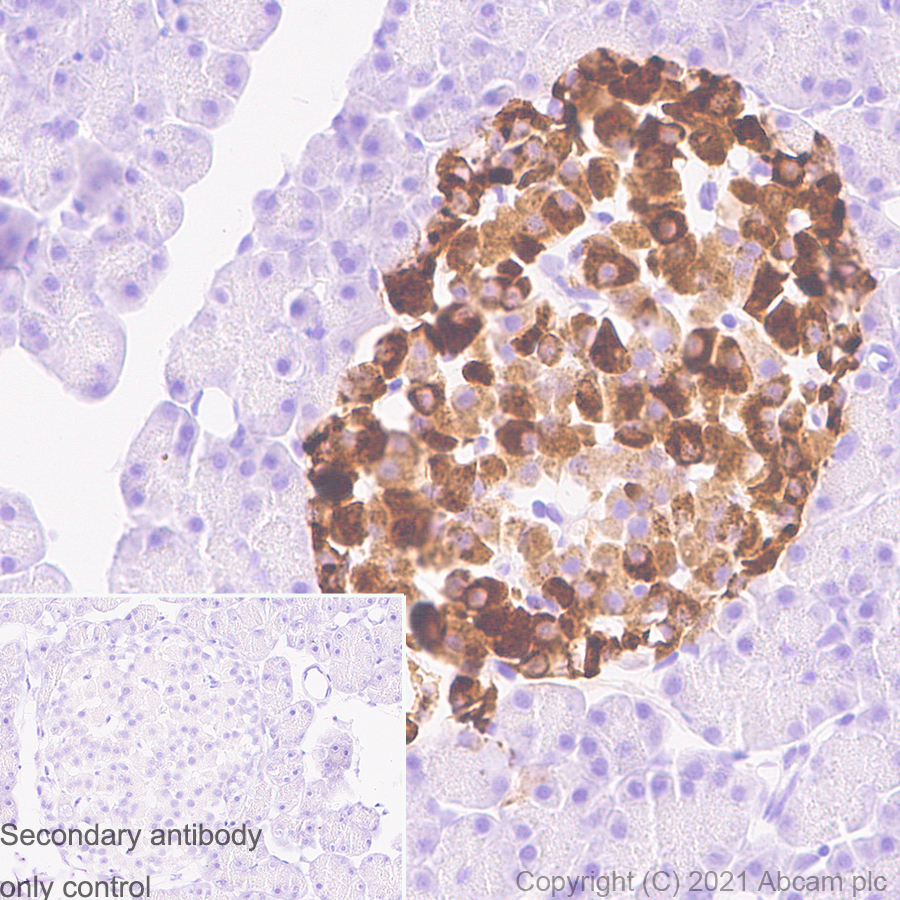 Immunohistochemistry (Formalin/PFA-fixed paraffin-embedded sections) - Anti-Chromogranin A antibody [RM1025] (ab283265), expandable thumbnail
